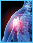 Post-Traumatic Rehabilitation