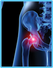 Joint Diseases