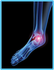 Foot & Ankle Conditions