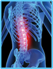 Back Pain