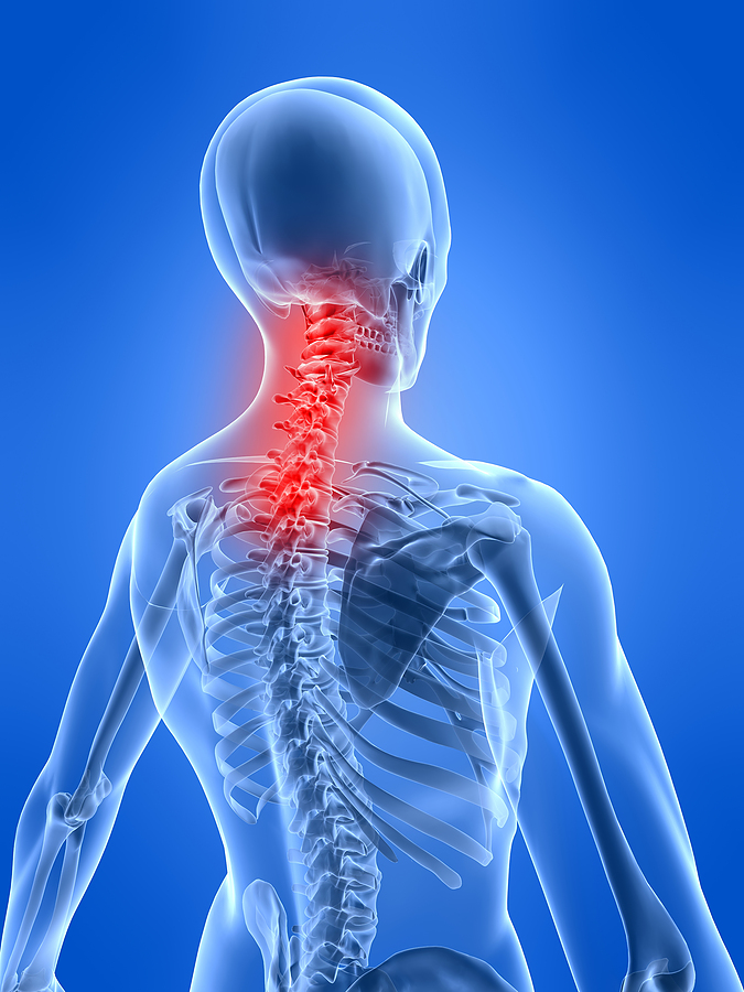 What to Do About Your Neck Pain  Get Relief from Ongoing Neck Pains