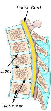 Lumbar Stenosis - side view