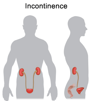 Incontinence