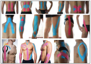 Kinesio Taping reduces pain, swelling, scar tissue, muscle activity | Kinesio Taping improves healing, posture, nerve receptors, muscle contraction